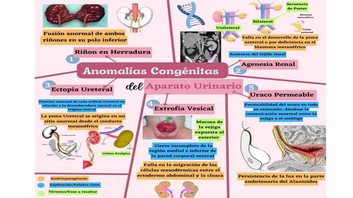 Anomalías Urinarias embriología  