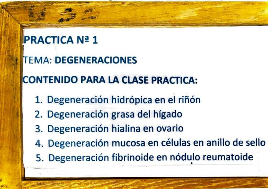 Degeneraciones 