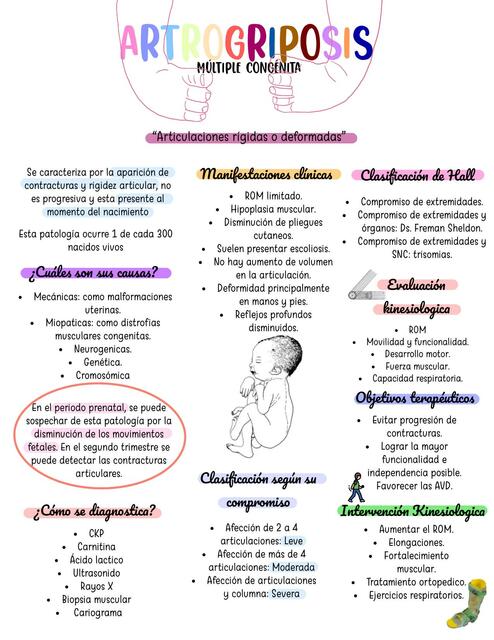 Infografia Artrogriposis