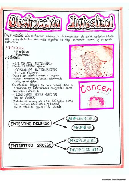 Obstrucción Intestinal 