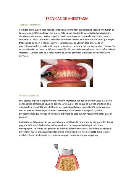 Técnicas de Anestesia 