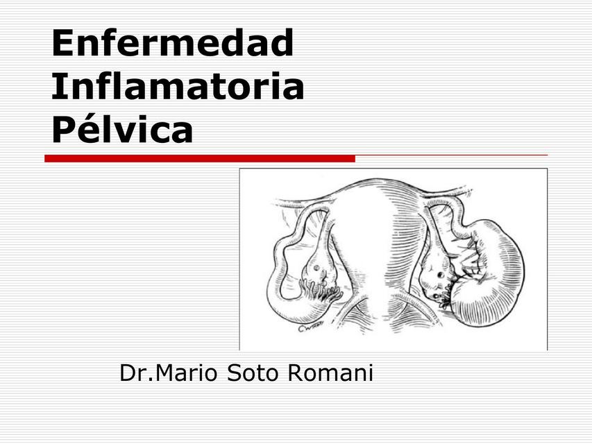 Enfermedad Inflamatoria Pélvica 