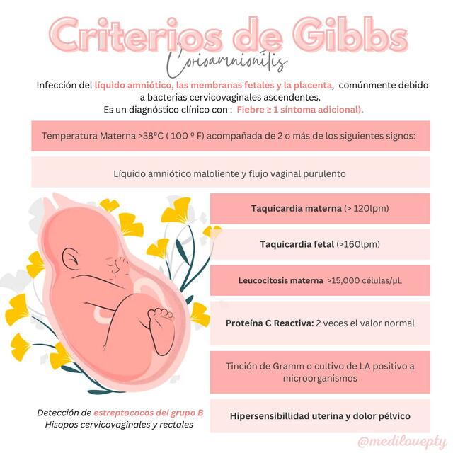 Criterios de Gibbs