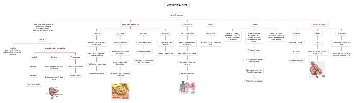 Apendicitis Aguda 