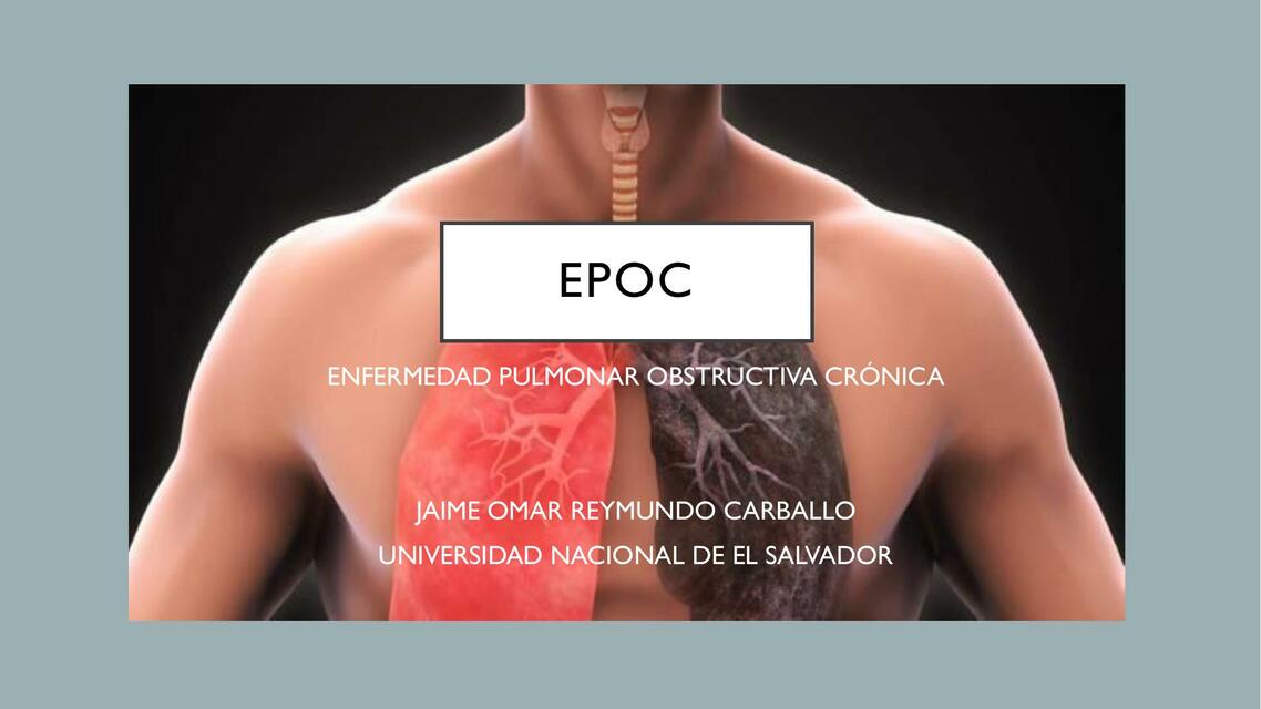 EPOC