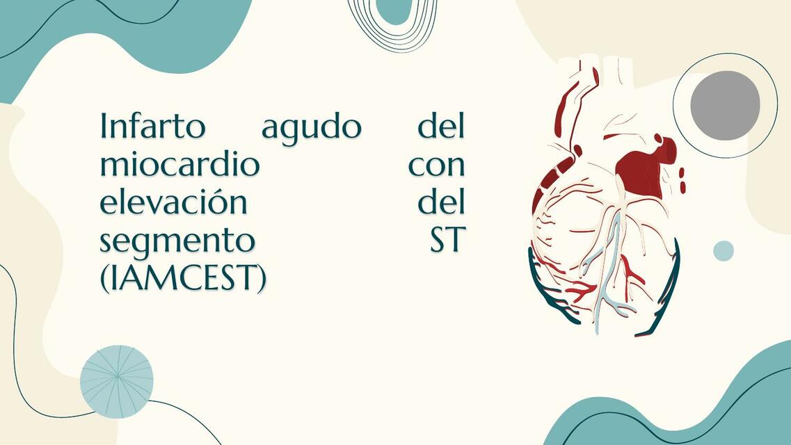 Infarto agudo al miocardio con elevación del segmento ST