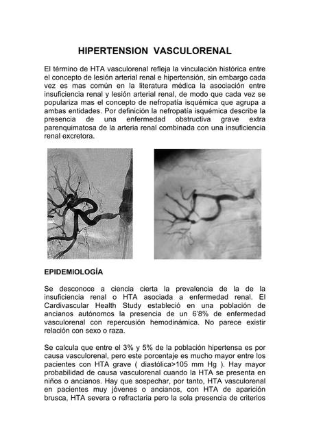 Hipertensión Vasculorrenal 