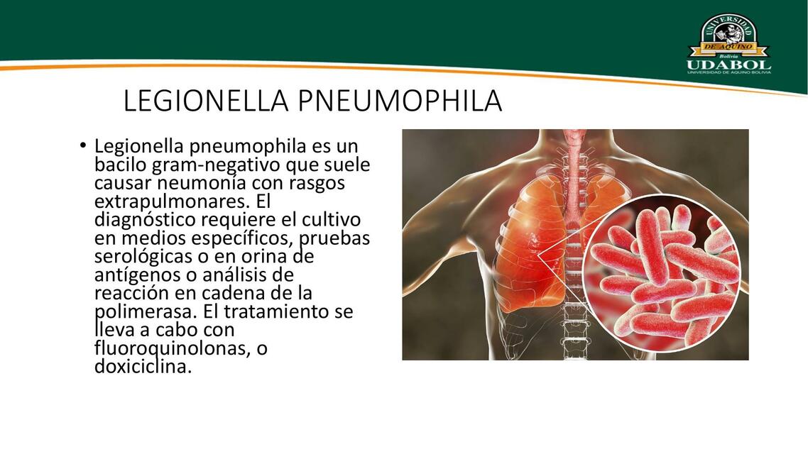 Legionella pneumophila