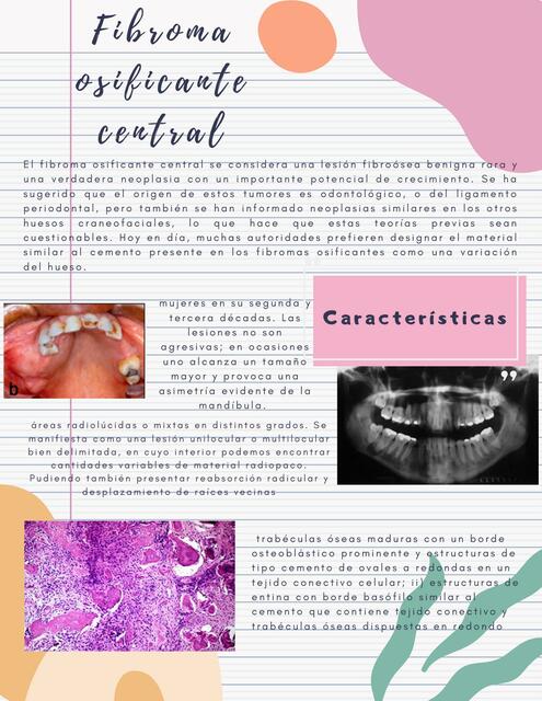 Fibroma Osificante Central