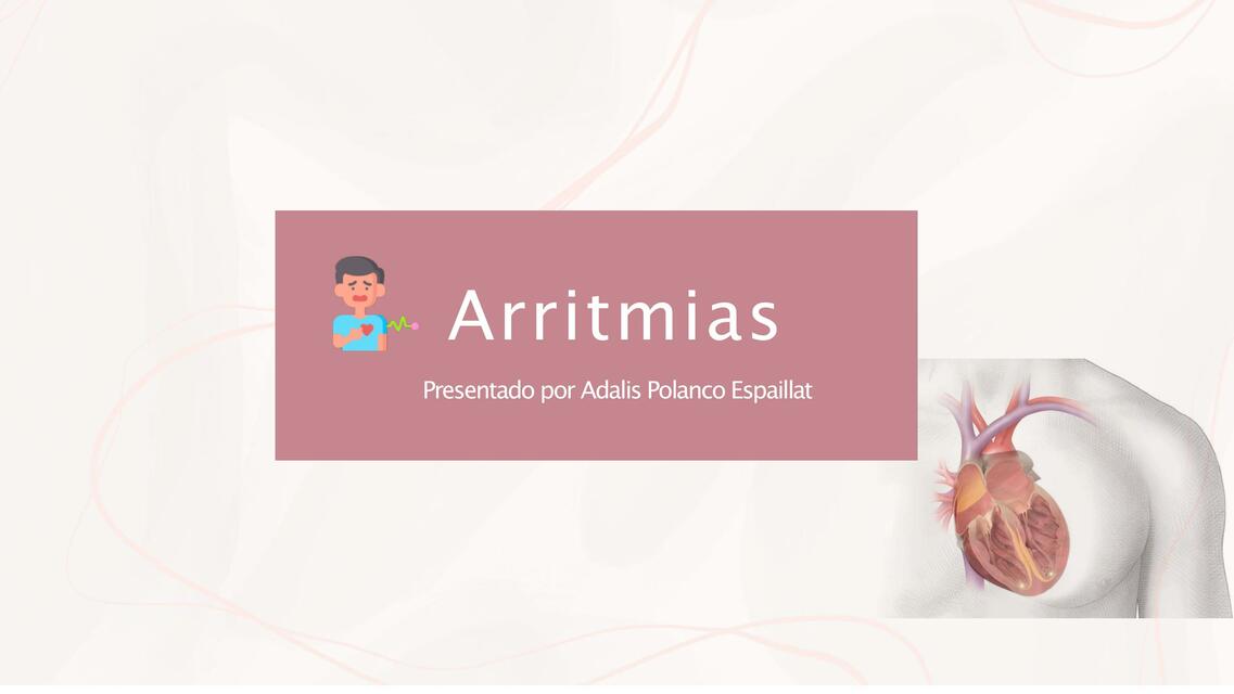 Arritmias