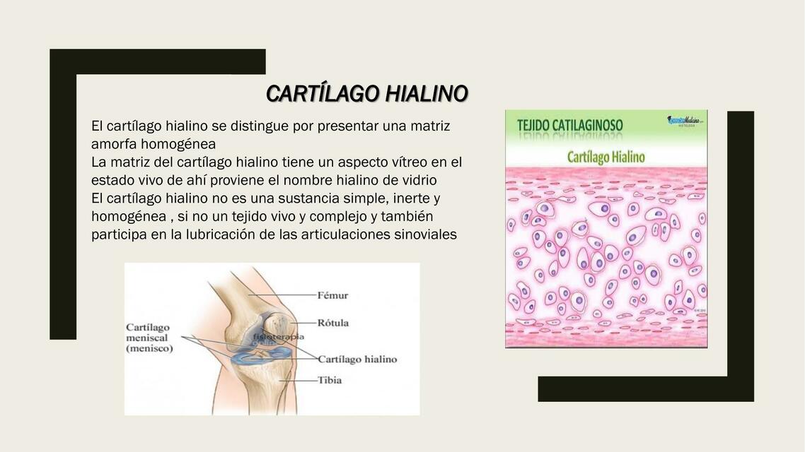 Cartílago hiliano.