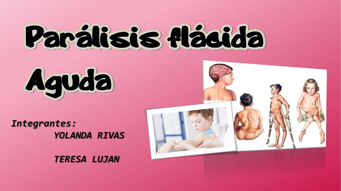 Parálisis Flácida Aguda 