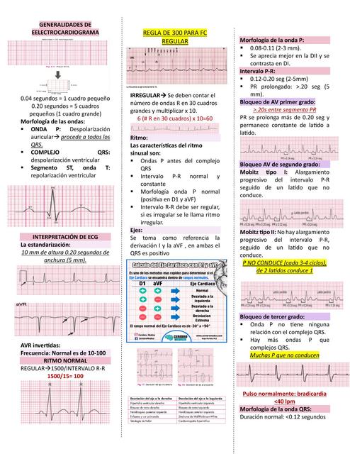 Generalidades de Electrocardiograma  