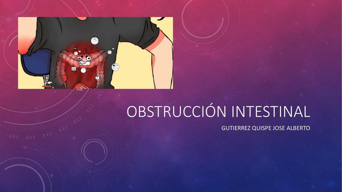 Obstrucción Intestinal