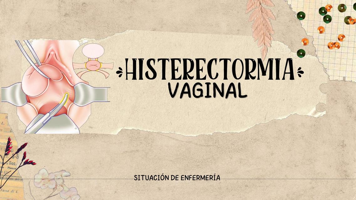 Histerectomía Vaginal 