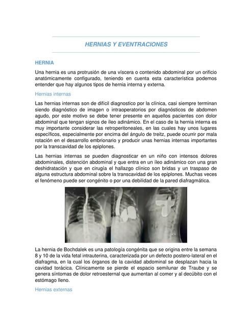 Hernias y Eventraciones | Juanita Zapata | uDocz