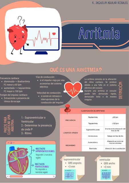 Arritmia Jaquelin Aguilar Udocz Arritmia Jaquelin Aguilar Udocz