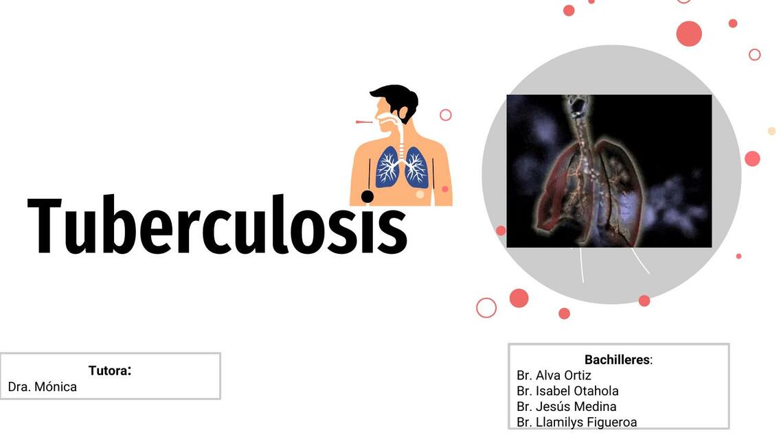 tuberculosis en  Pediatría 