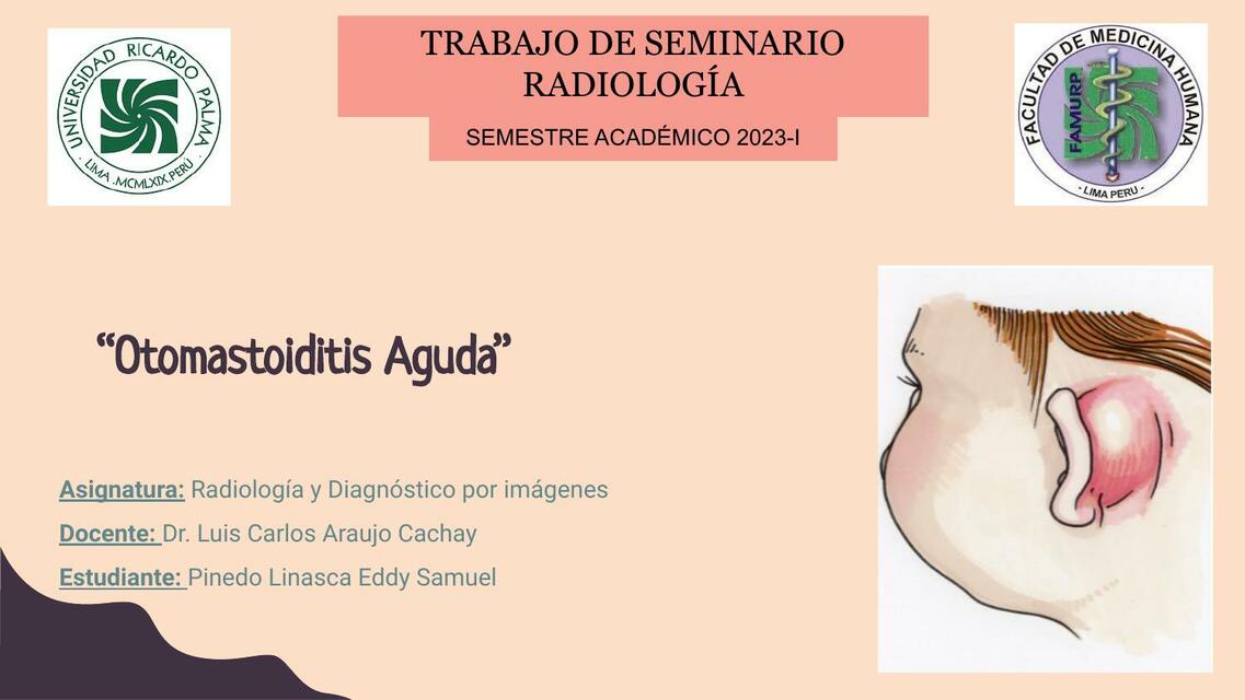 Otomastoiditis Aguda