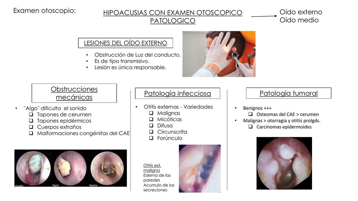 Hipoacusia examen otoscópico normal y patológico