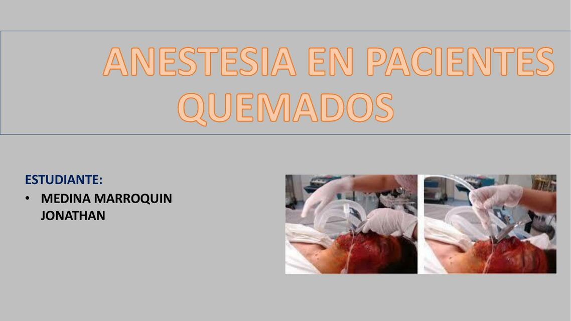 Anestesia en pacientes quemados 