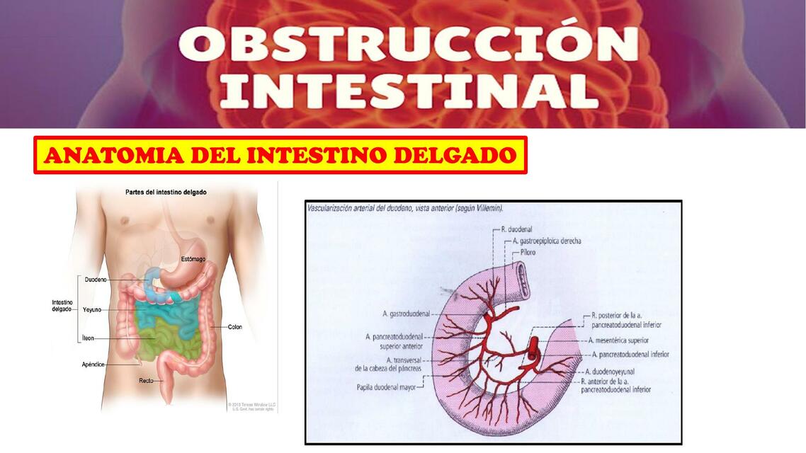 Obstrucción intestinal