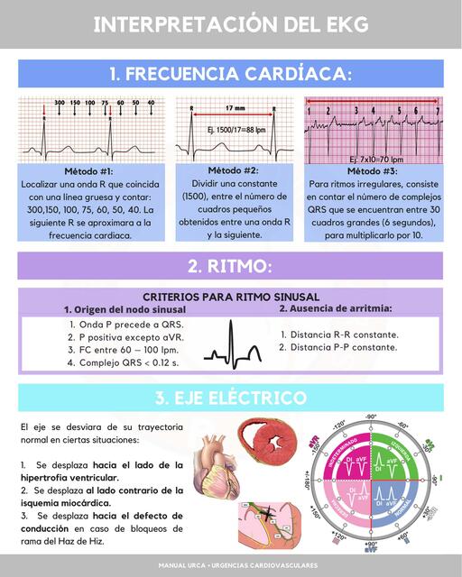 Interpretación del EKG