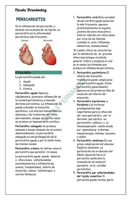 Pericarditis