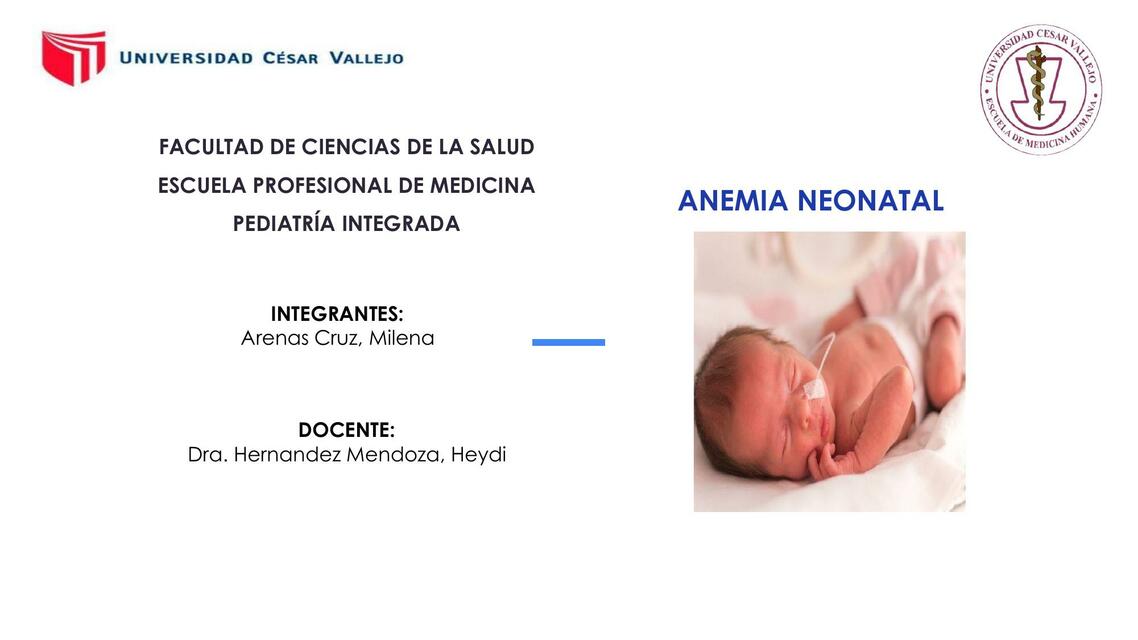 Anemia Neonatal 