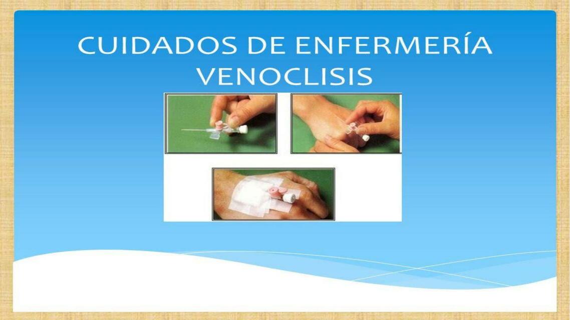 Cuidados De Enfermería En La Venoclisis | Aura Ester Peréz Rada | uDocz