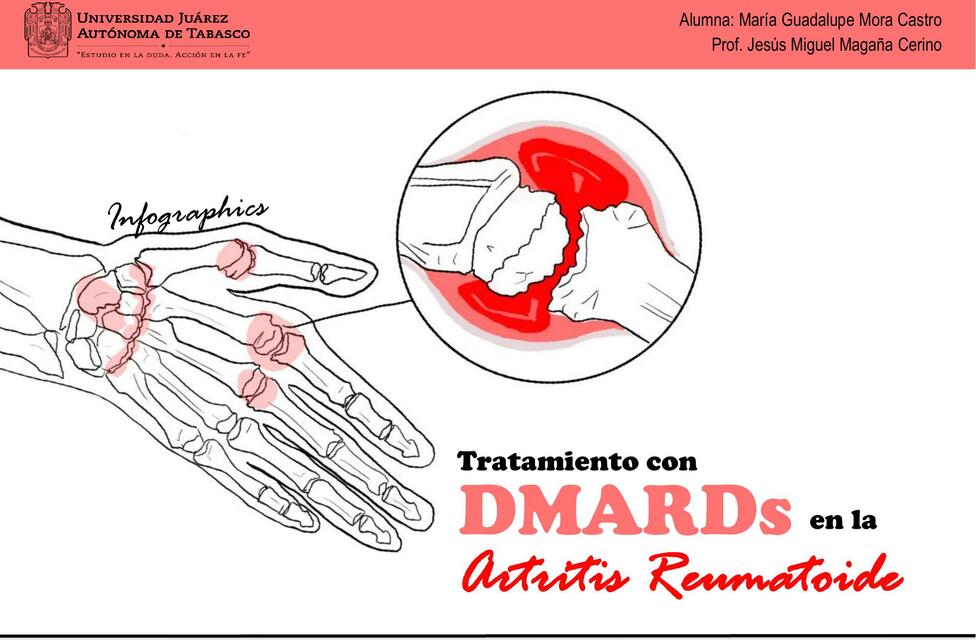 Tratamiento con DMARDs en la Artritis Reumatoide