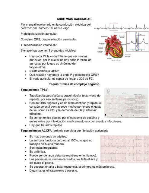 Arritmias cardiacas 