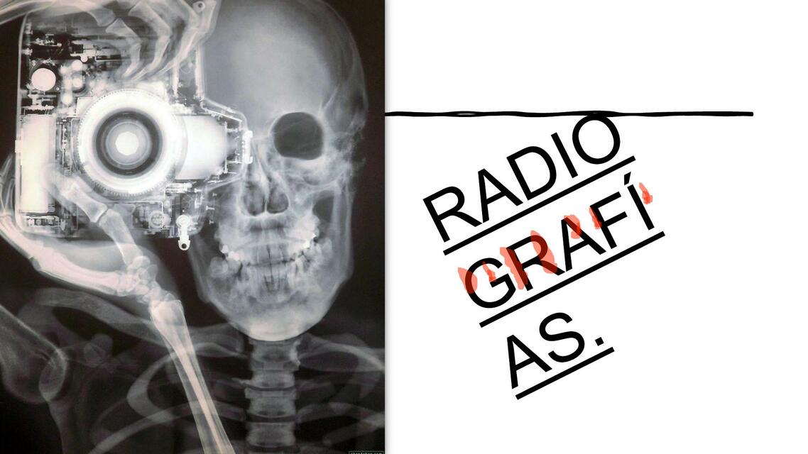 Radiografías 