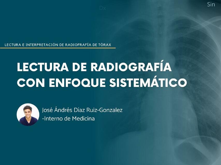 Lectura Sistemática Radiológica