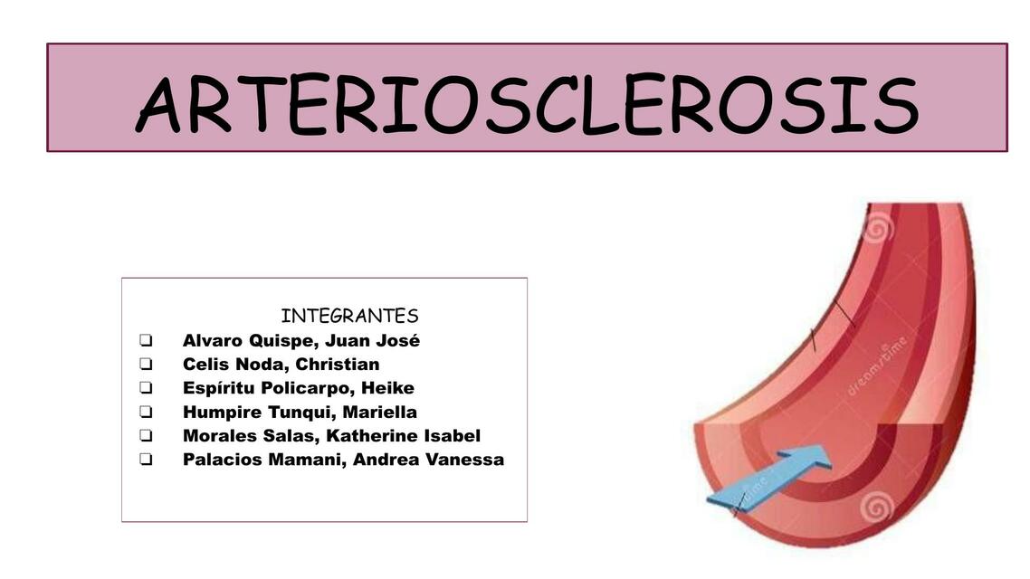 Arteriosclerosis 