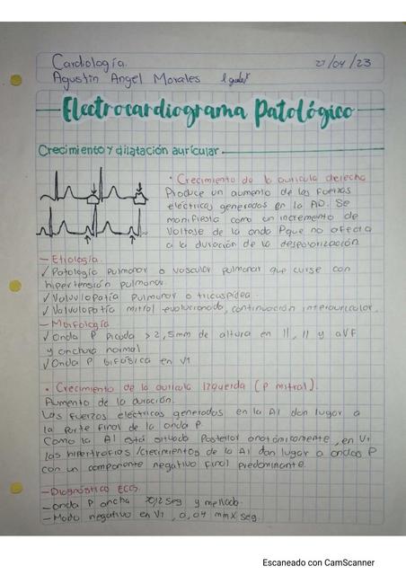 Electrocardiograma Patológico