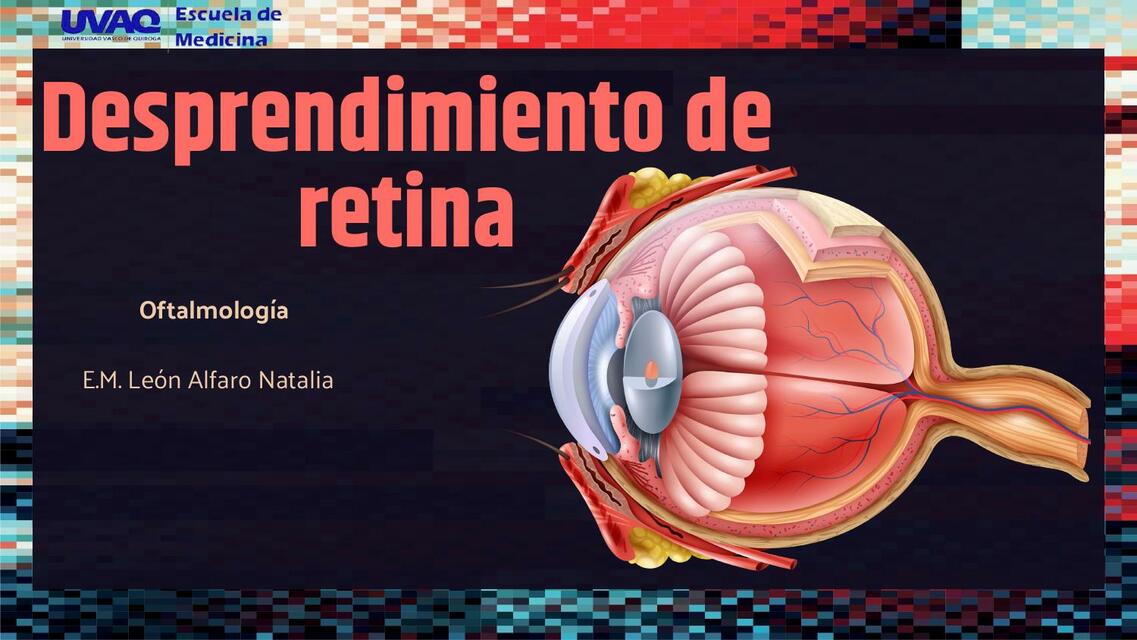 Desprendimiento de retina