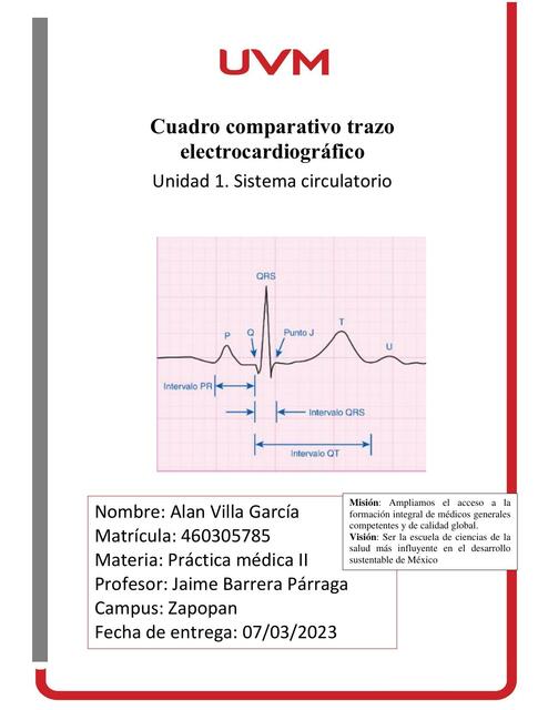 Cuadro Comparativo/ Trazo Electrocardiográfico