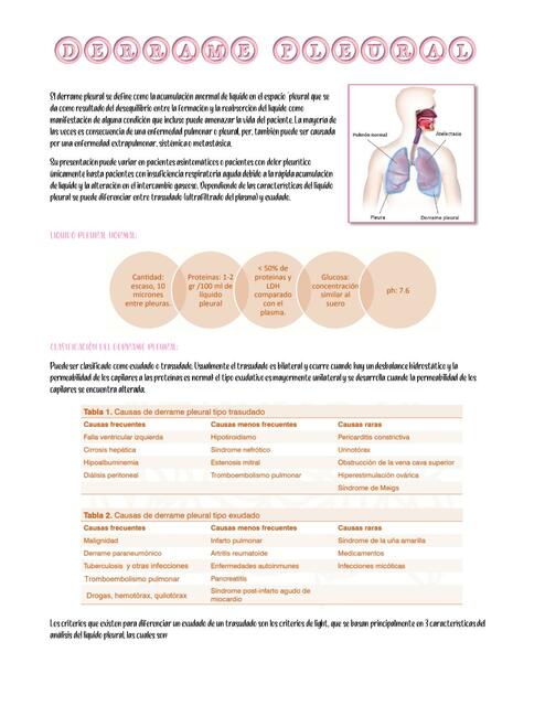 Derrame Pleural