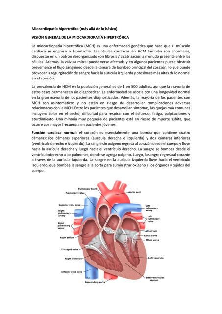 Miocardiopatía hipertrófica