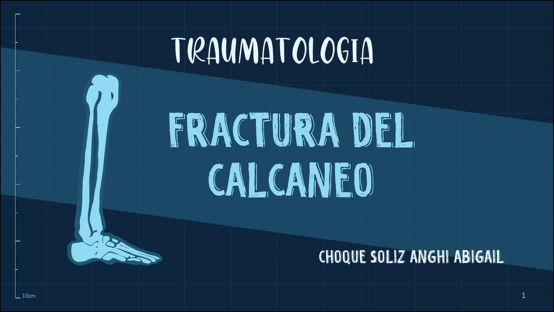 Fractura de Calcáneo 