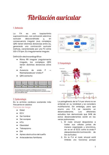Fibrilación auricular 