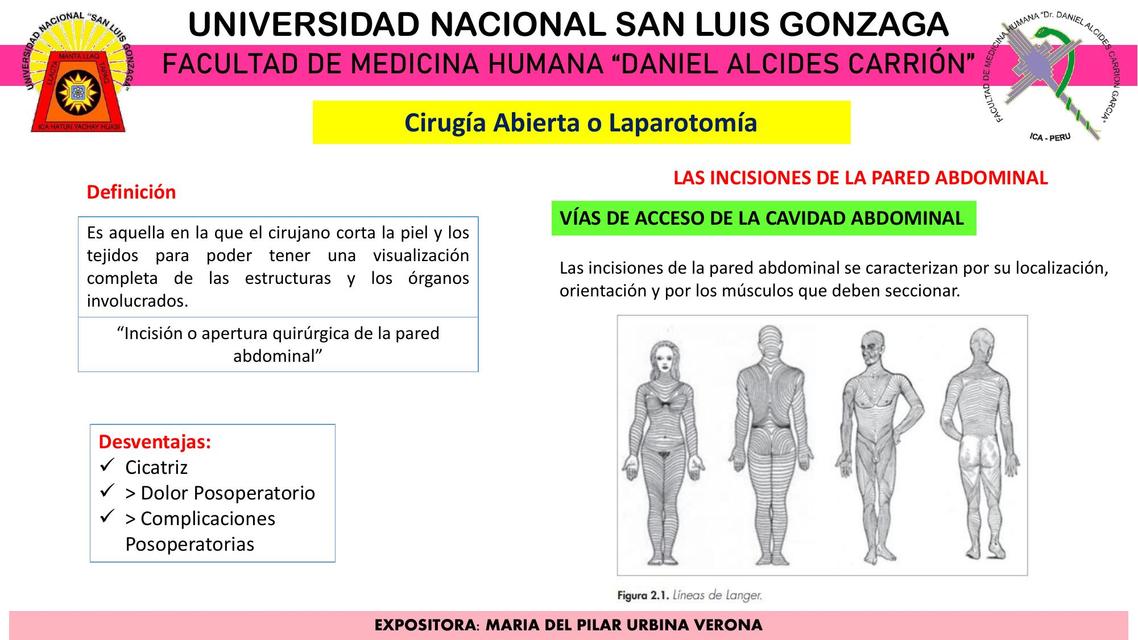 Cirugía abierta o Laparotomía  