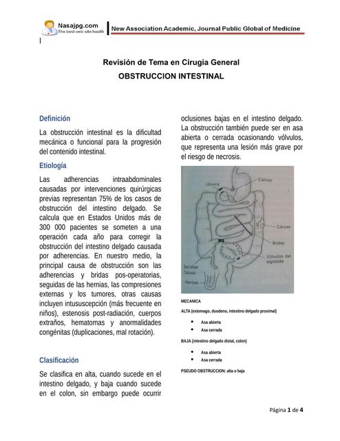 Obstrucción Intestinal 