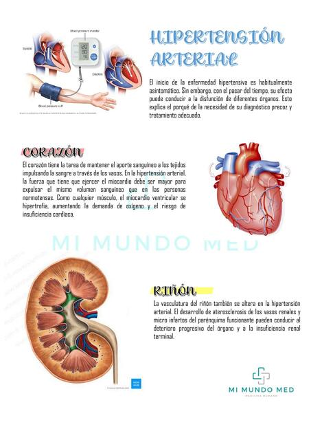 Hipertensión Arterial