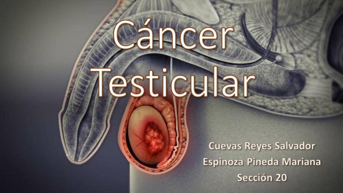 Cáncer testicular