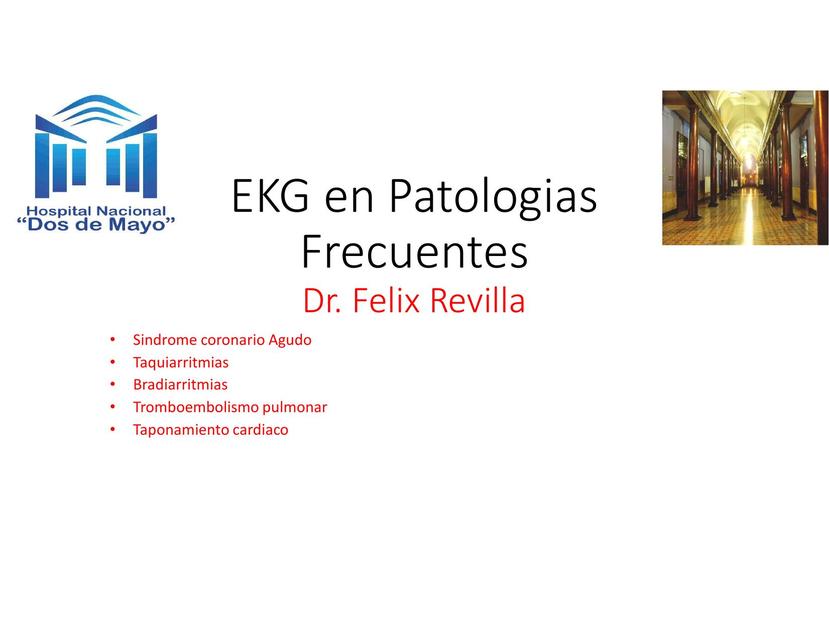 EKG en patologías frecuentes 