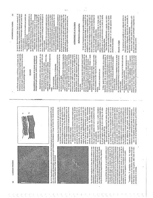 Alteraciones de la placenta  