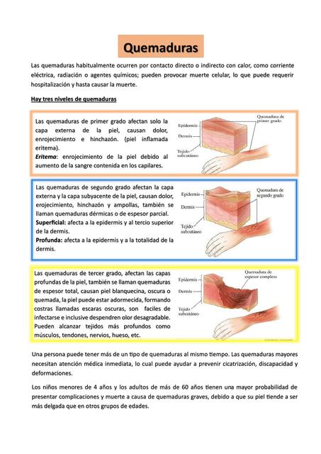 Quemaduras y Vendaje 