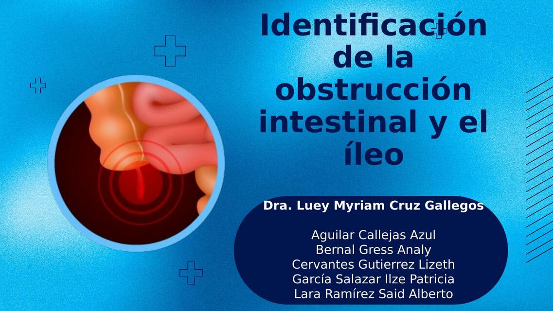 Identificación de la Obstrucción Intestinal y el Íleo